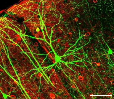 A pyramidal neuron from the hippocampus, stained for green fluorescent protein
